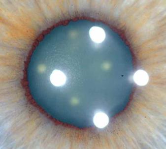 corso di iridologia a bologna immagine occhio 3